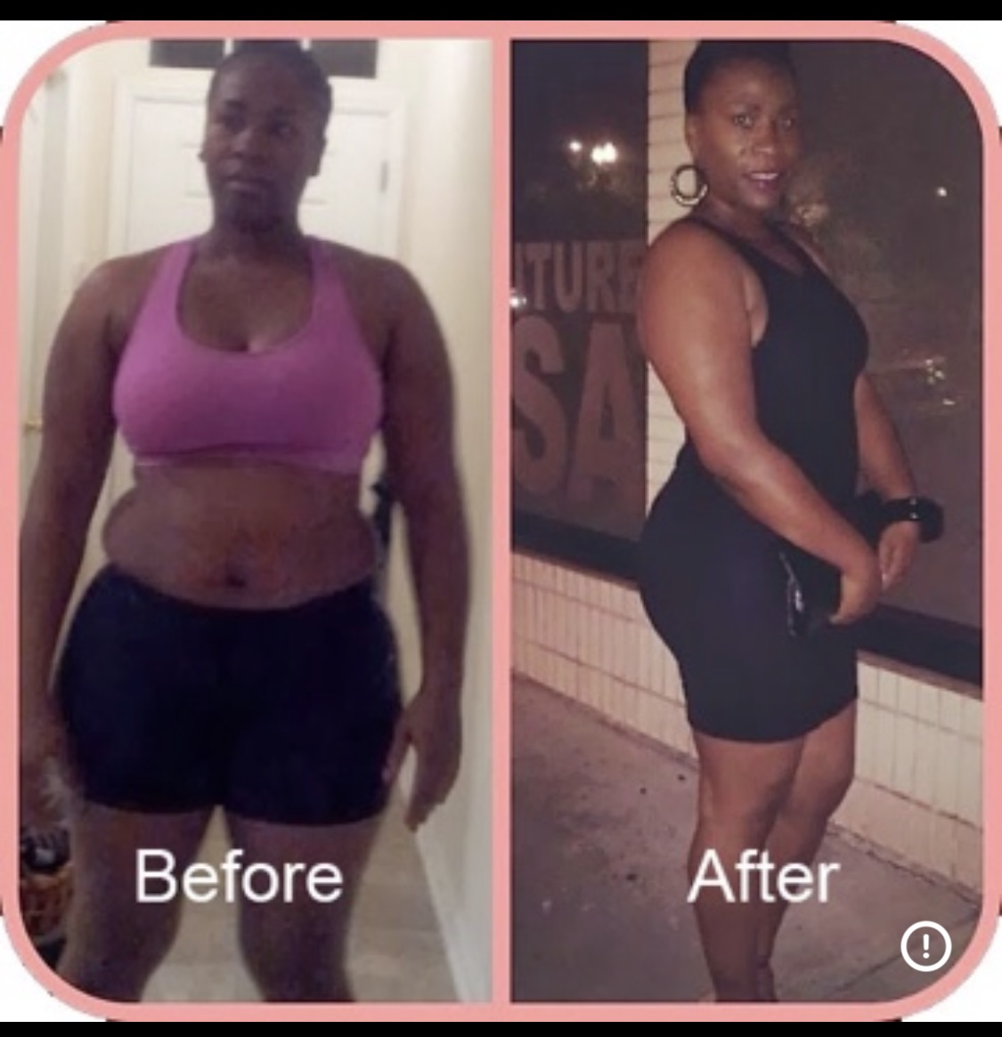 Miami Body client transformation 4