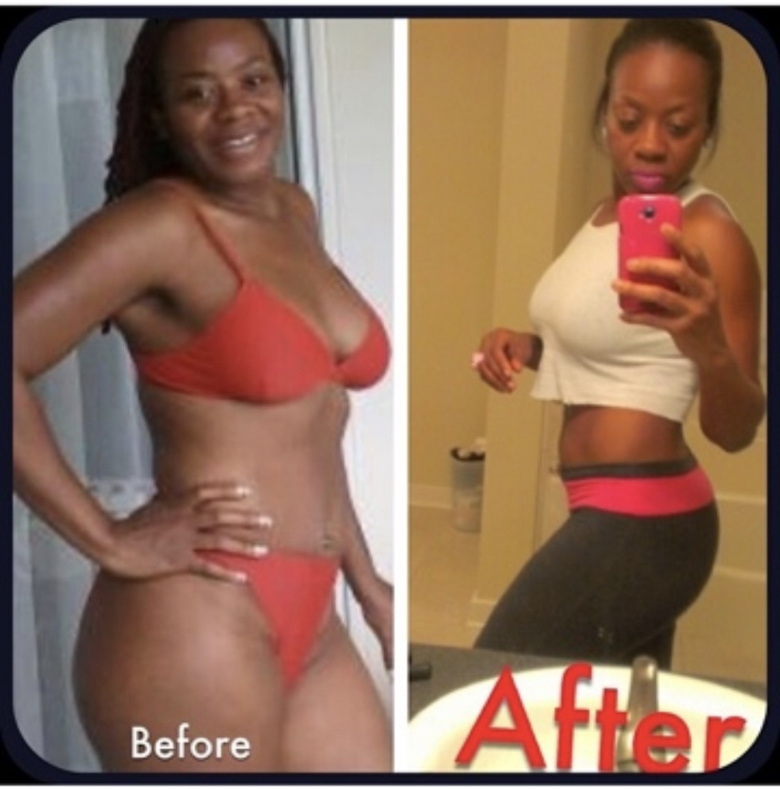 Miami Body client transformation 5